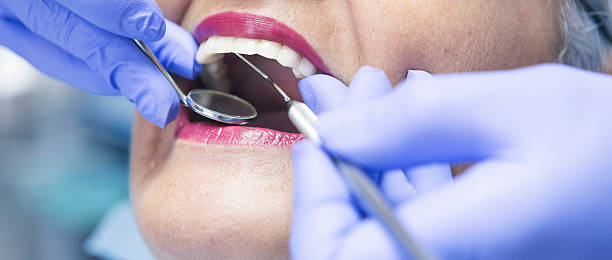 Best Teeth Whitening  in Maysville, GA